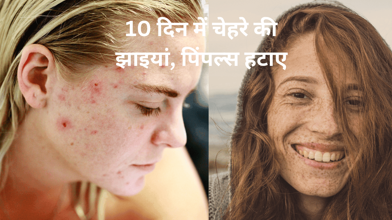 चेहरे की झाइयां