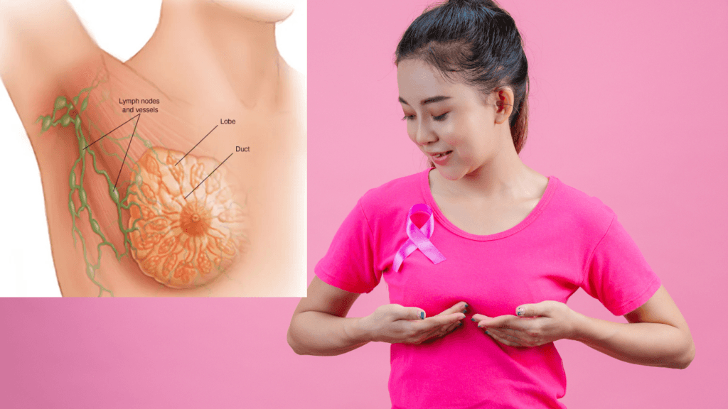 Breast Cancer in Hindi: 3 Early Symptoms and Easy Treatment Tips 2 Breast Cancer in Hindi