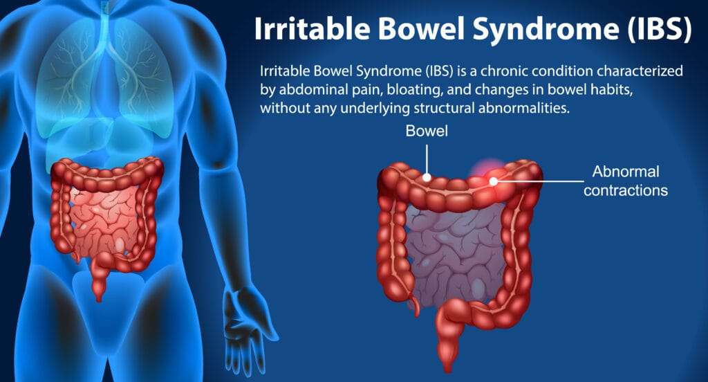 Gut Microbiome Health: 6 Signs That Your Gut Health is Not Good and How to Improve It. 4 Gut Microbiome Health